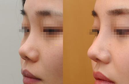 Goodbye Spots