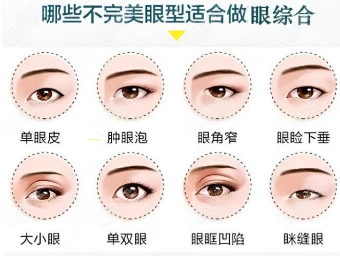 抽脂下巴多少钱（下巴抽脂手术大概花多少钱）